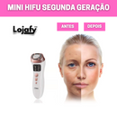 MINI HIFU SEGUNDA GERAÇÃO LOJAFY